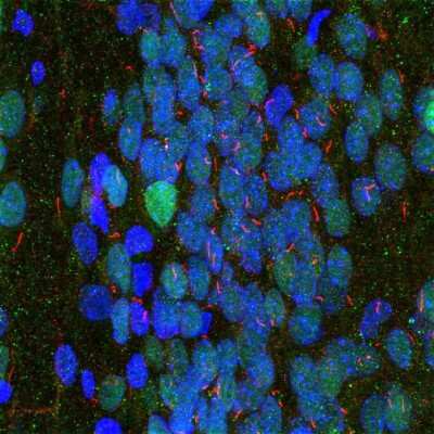 Immunocytochemistry/ Immunofluorescence: Adenylate Cyclase 3 Antibody [NBP2-60792]