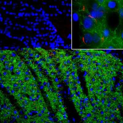 Immunocytochemistry/ Immunofluorescence: Adenylate Cyclase 3 Antibody [NBP3-05526]