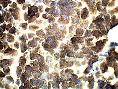 Immunohistochemistry-Paraffin: Adenylate Cyclase 3 Antibody [NBP3-12369]