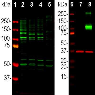 Western Blot: Adenylate Cyclase 3 Antibody [NBP3-05527]
