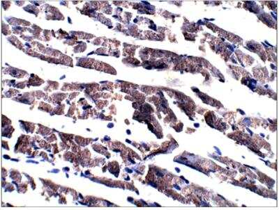 Immunohistochemistry-Paraffin: Adenylate Cyclase 6 Antibody [NBP3-12233]