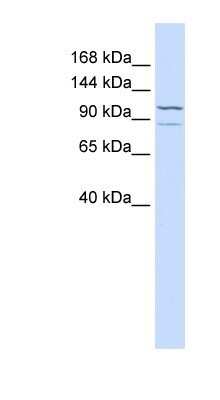 Western Blot: Adenylate Cyclase 6 Antibody [NBP1-59023]