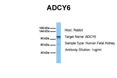 Western Blot: Adenylate Cyclase 6 Antibody [NBP1-59023]