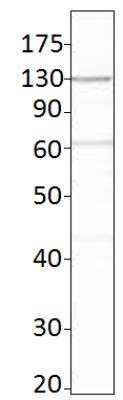 Western Blot: Adenylate Cyclase 6 Antibody [NBP3-12233]