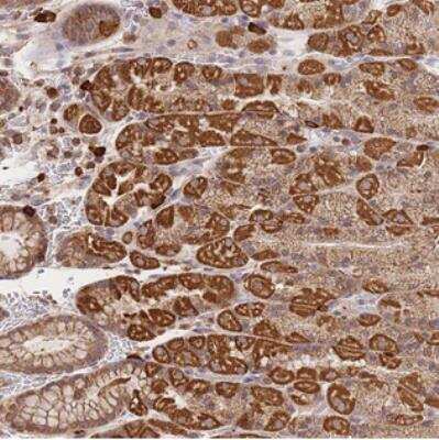 Immunohistochemistry: Adenylate Cyclase 9 Antibody [NBP2-30380]