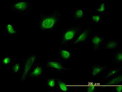 Immunocytochemistry/ Immunofluorescence: Adenylate Kinase 1 Antibody (3A6-1F5) [H00000203-M06]