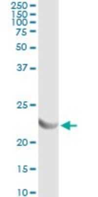Immunoprecipitation: Adenylate Kinase 1 Antibody (3A6-1F5) [H00000203-M06]