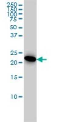Western Blot: Adenylate Kinase 1 Antibody (3A6-1F5) [H00000203-M06]