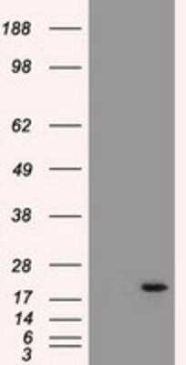Western Blot: Adenylate Kinase 1 Antibody (OTI4A1) [NBP1-47655]