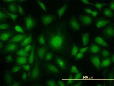 Immunocytochemistry/ Immunofluorescence: Adenylate Kinase 1 Antibody (M1) [H00000203-M08]