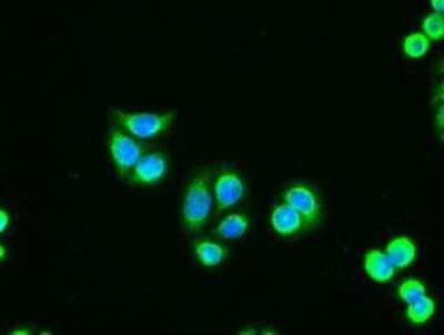 Immunocytochemistry/ Immunofluorescence: Adenylate Kinase 1 Antibody (OTI4A1) - Azide and BSA Free [NBP2-70123]