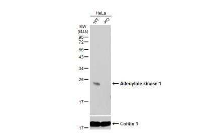 Western Blot: Adenylate Kinase 1 Antibody [NBP2-15295]