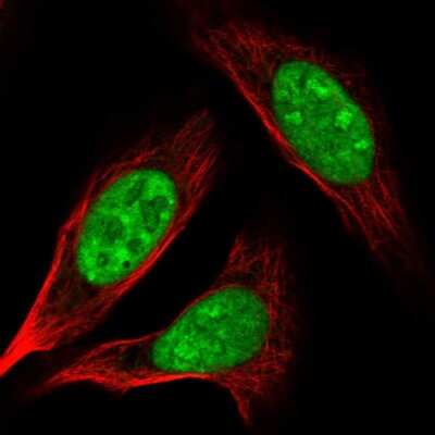Immunocytochemistry/ Immunofluorescence: Adenylate Kinase 6 Antibody [NBP2-56093]