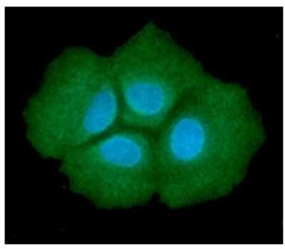 Immunocytochemistry/ Immunofluorescence: Adenylosuccinate Lyase Antibody (16C10) - BSA Free [NBP2-59414]