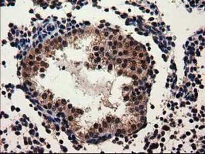 Immunohistochemistry: Adenylosuccinate Lyase Antibody (OTI2D10) - Azide and BSA Free [NBP2-70101]