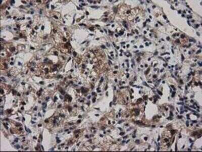 Immunohistochemistry-Paraffin: Adenylosuccinate Lyase Antibody (OTI2D10) [NBP2-03107]