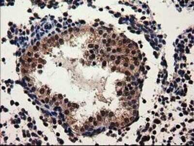 Immunohistochemistry-Paraffin: Adenylosuccinate Lyase Antibody (OTI2D10) [NBP2-03107]