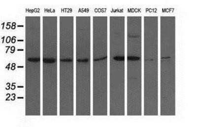 Western Blot: Adenylosuccinate Lyase Antibody (OTI2D10) [NBP2-03107]