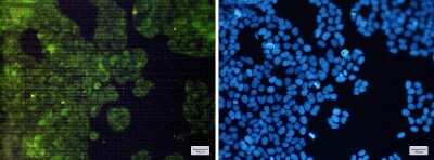 Immunocytochemistry/ Immunofluorescence: Adenylosuccinate Synthase Antibody (S05-8F8) [NBP3-14991]