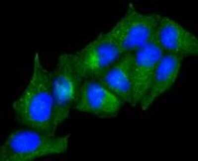 Immunocytochemistry/ Immunofluorescence: AdipoR1 Antibody (SC69-04) [NBP2-67631]