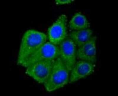 Immunocytochemistry/ Immunofluorescence: AdipoR1 Antibody (SC69-04) [NBP2-67631]