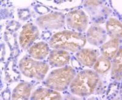 Immunohistochemistry-Paraffin: AdipoR1 Antibody (SC69-04) [NBP2-67631]