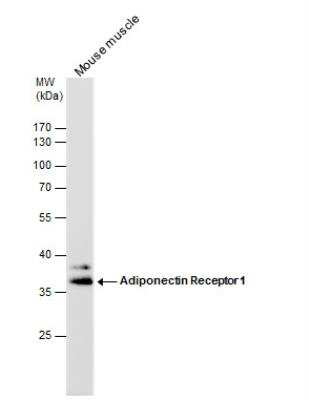 Western Blot: AdipoR1 Antibody [NBP2-15300]