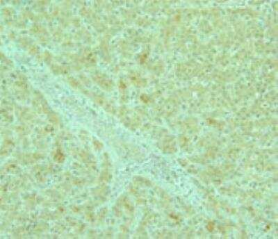 Immunohistochemistry-Paraffin: AdipoR2 Antibody [NBP1-28641]