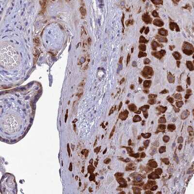 Immunohistochemistry-Paraffin: AdipoR2 Antibody [NBP1-91652]