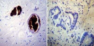 Immunohistochemistry-Paraffin: Adiponectin/Acrp30 Antibody (19F1) [NBP2-22450]