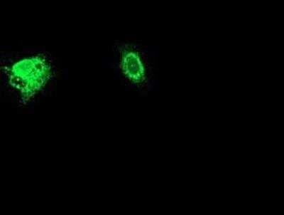 Immunocytochemistry/ Immunofluorescence: Adiponectin/Acrp30 Antibody (OTI1H1) [NBP2-01418]