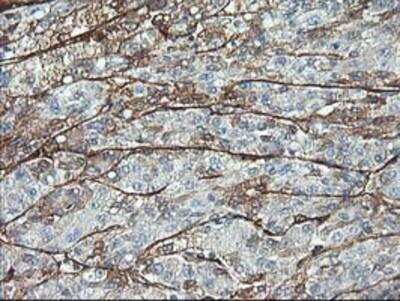 Immunohistochemistry-Paraffin: Adiponectin/Acrp30 Antibody (OTI1H1) [NBP2-01418]