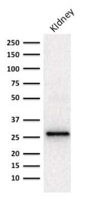 Western Blot: Adiponectin/Acrp30 Antibody (ADPN/1370) [NBP2-47652]
