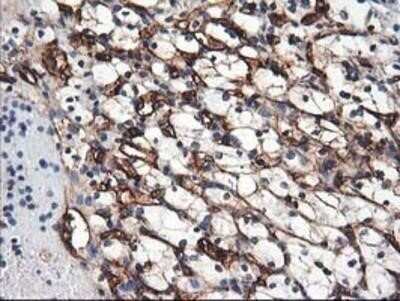 Immunohistochemistry: Adiponectin/Acrp30 Antibody (OTI1H1) - Azide and BSA Free [NBP2-71422]
