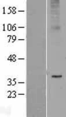 Western Blot: AdipoR2 Overexpression Lysate [NBL1-07344]