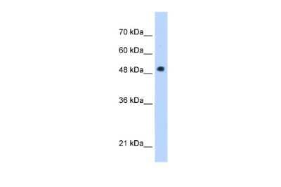 Western Blot: Adiponutrin/PNPLA3 Antibody [NBP1-54611]