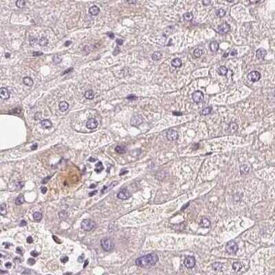 Immunohistochemistry-Paraffin: Afamin Antibody [NBP1-89156]