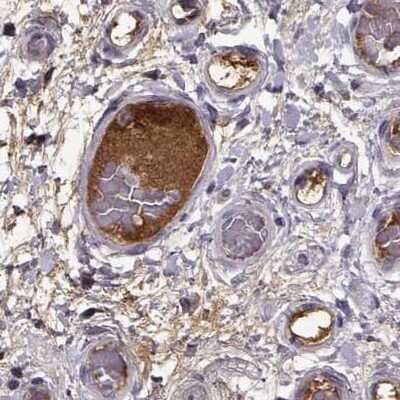 Immunohistochemistry-Paraffin: Afamin Antibody [NBP2-68702]