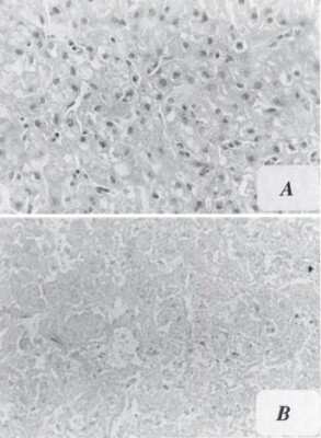 Immunohistochemistry: Aflatoxin B1 Antibody (6A10) - BSA Free [NB600-443]