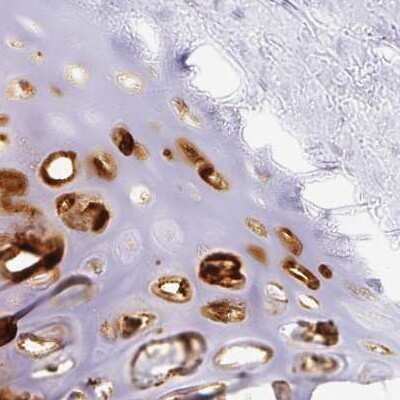 Immunohistochemistry-Paraffin: Aggrecan Antibody [NBP2-55539]