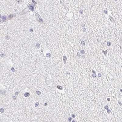 Immunohistochemistry-Paraffin: Aggrecan Antibody [NBP2-55539]