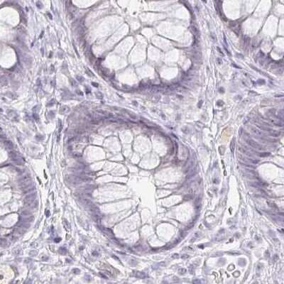 Immunohistochemistry-Paraffin: Aggrecan Antibody [NBP2-55539]