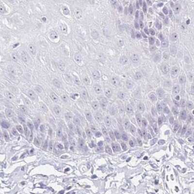 Immunohistochemistry-Paraffin: Aggrecan Antibody [NBP2-55539]