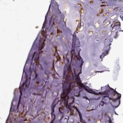 Immunohistochemistry-Paraffin: Aggrecan Antibody [NBP2-55540]