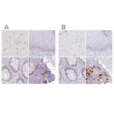 Immunohistochemistry-Paraffin: Aggrecan Antibody [NBP2-55540]