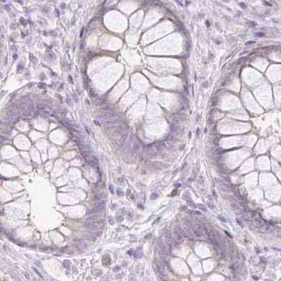 Immunohistochemistry-Paraffin: Aggrecan Antibody [NBP2-55540]