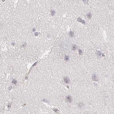 Immunohistochemistry-Paraffin: Aggrecan Antibody [NBP2-55540]