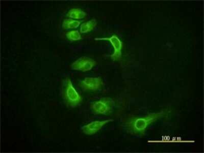 Immunocytochemistry/ Immunofluorescence: Ago2/eIF2C2 Antibody (2E12-1C9) [H00027161-M01]