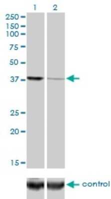 Western Blot: Ago2/eIF2C2 Antibody (2E12-1C9) [H00027161-M01]