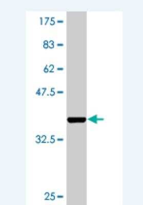 Western Blot: Ago2/eIF2C2 Antibody (2H2) [H00027161-M05]